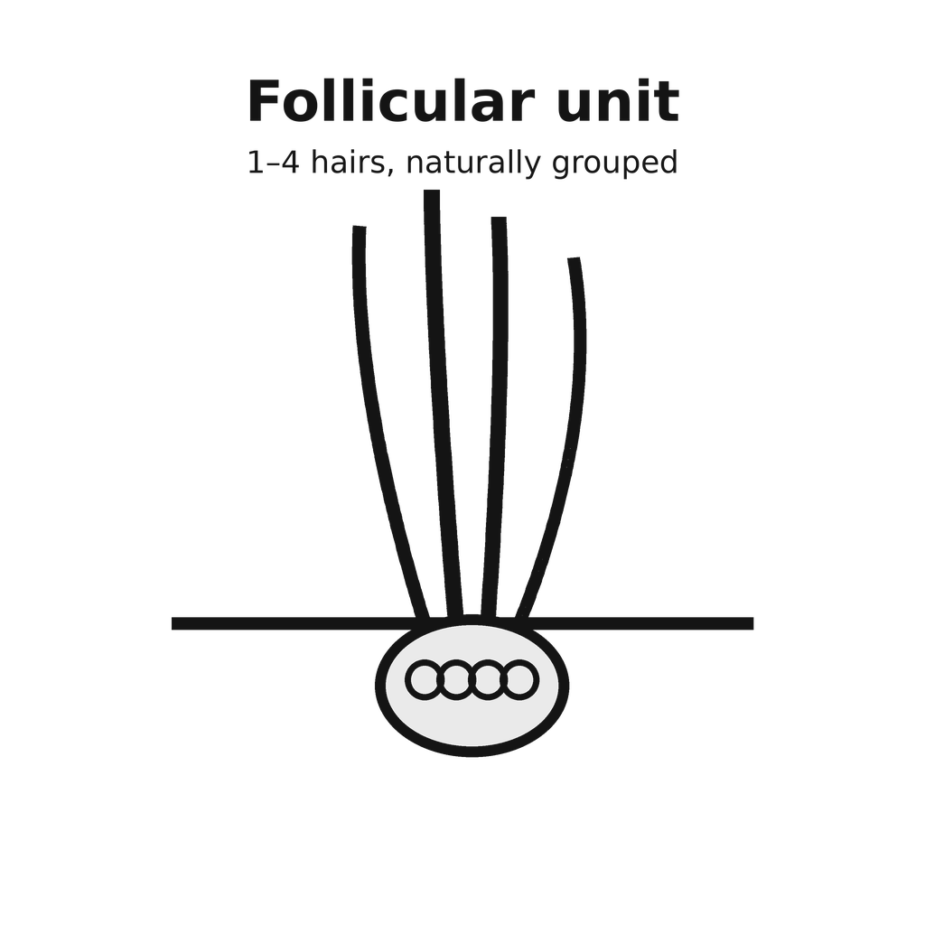 Illustration of a follicular unit containing one to four hairs