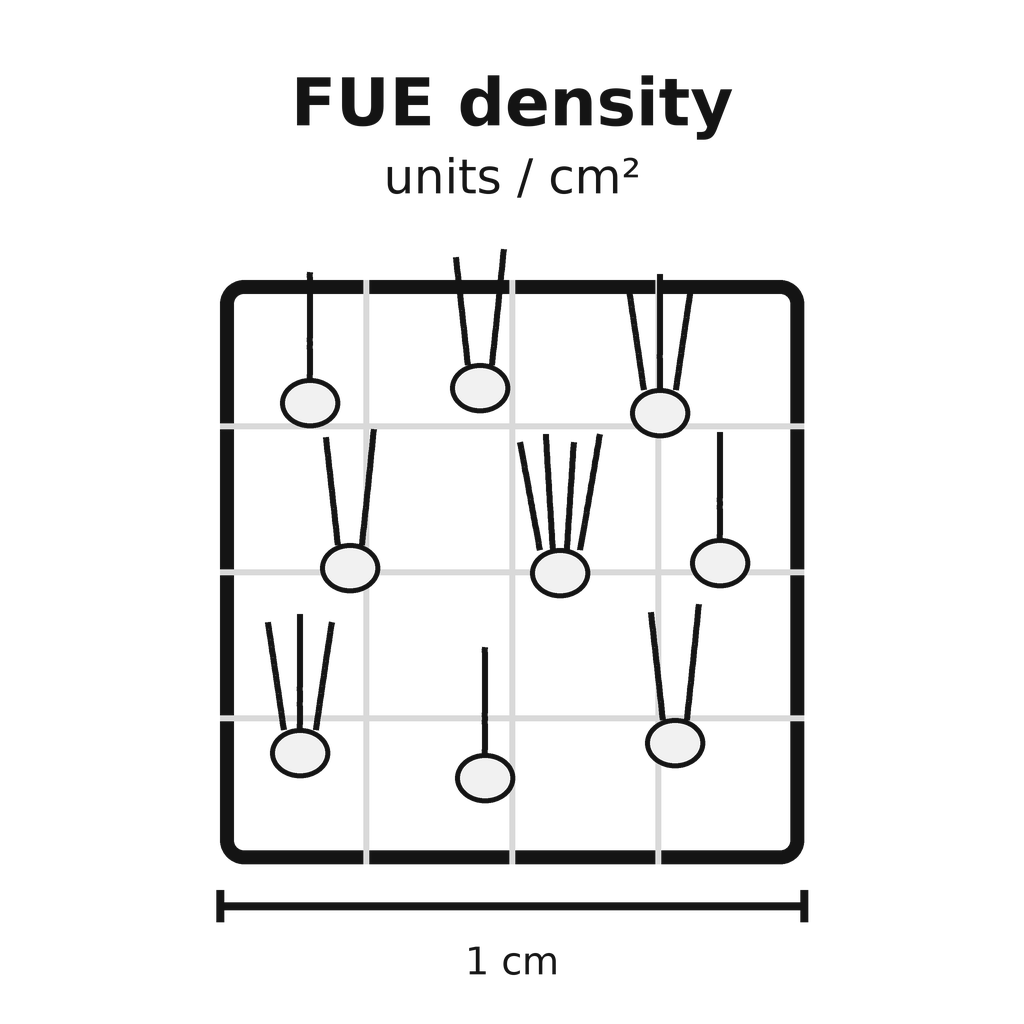 Educational illustration of follicular-unit density in FUE planning