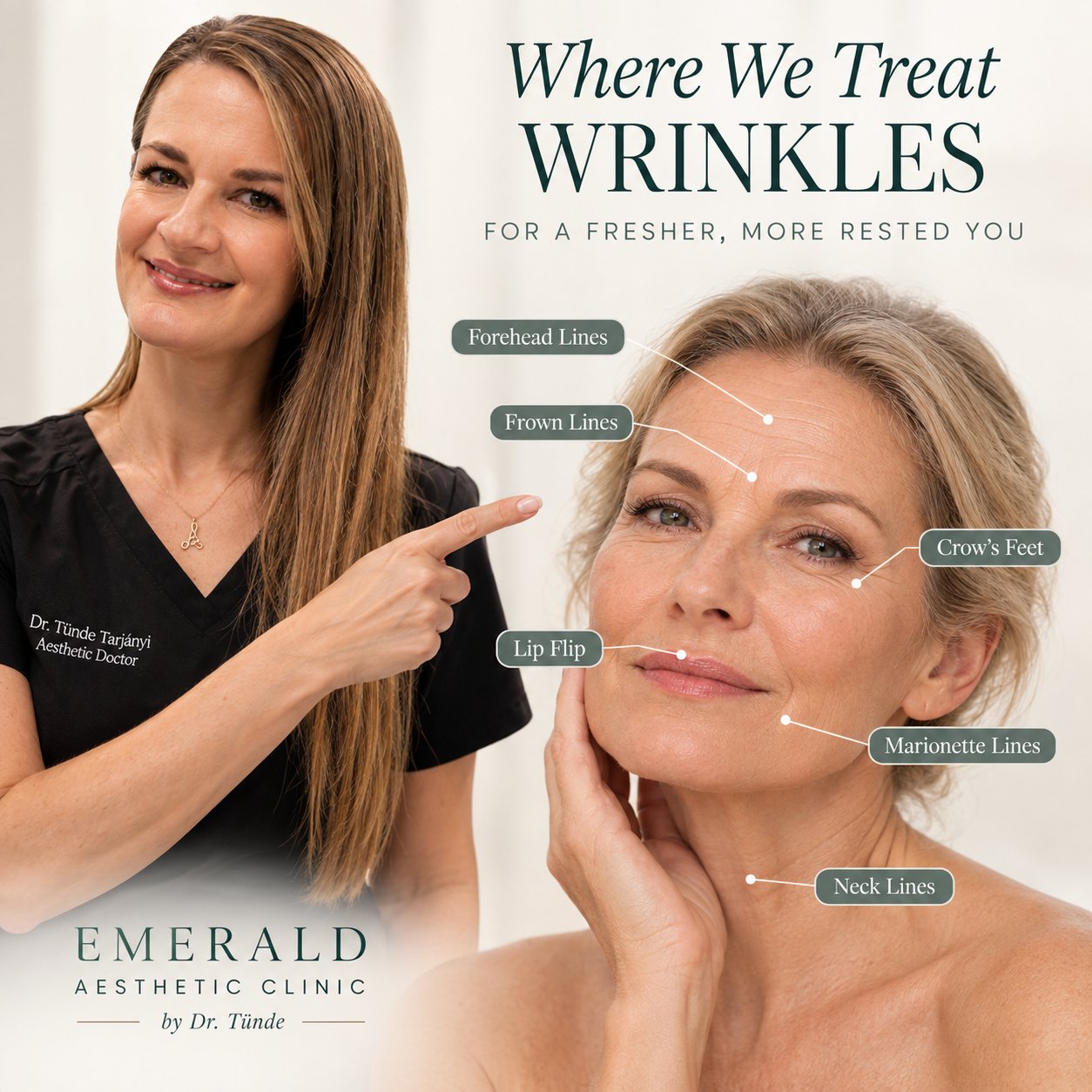 Doctor-led anti-wrinkle treatment at Emerald Aesthetic Clinic by Dr. Tünde in Dublin