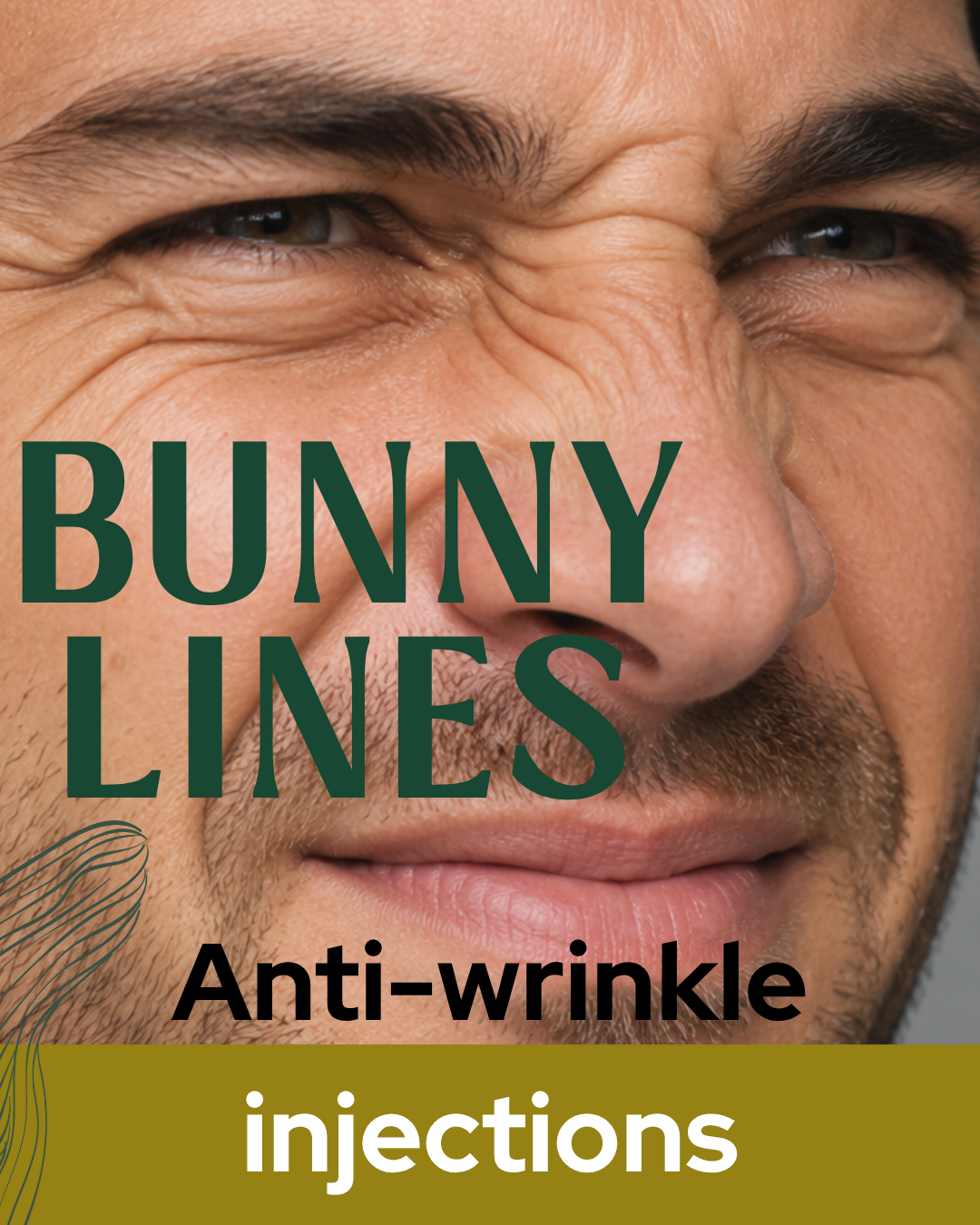 Bunny lines