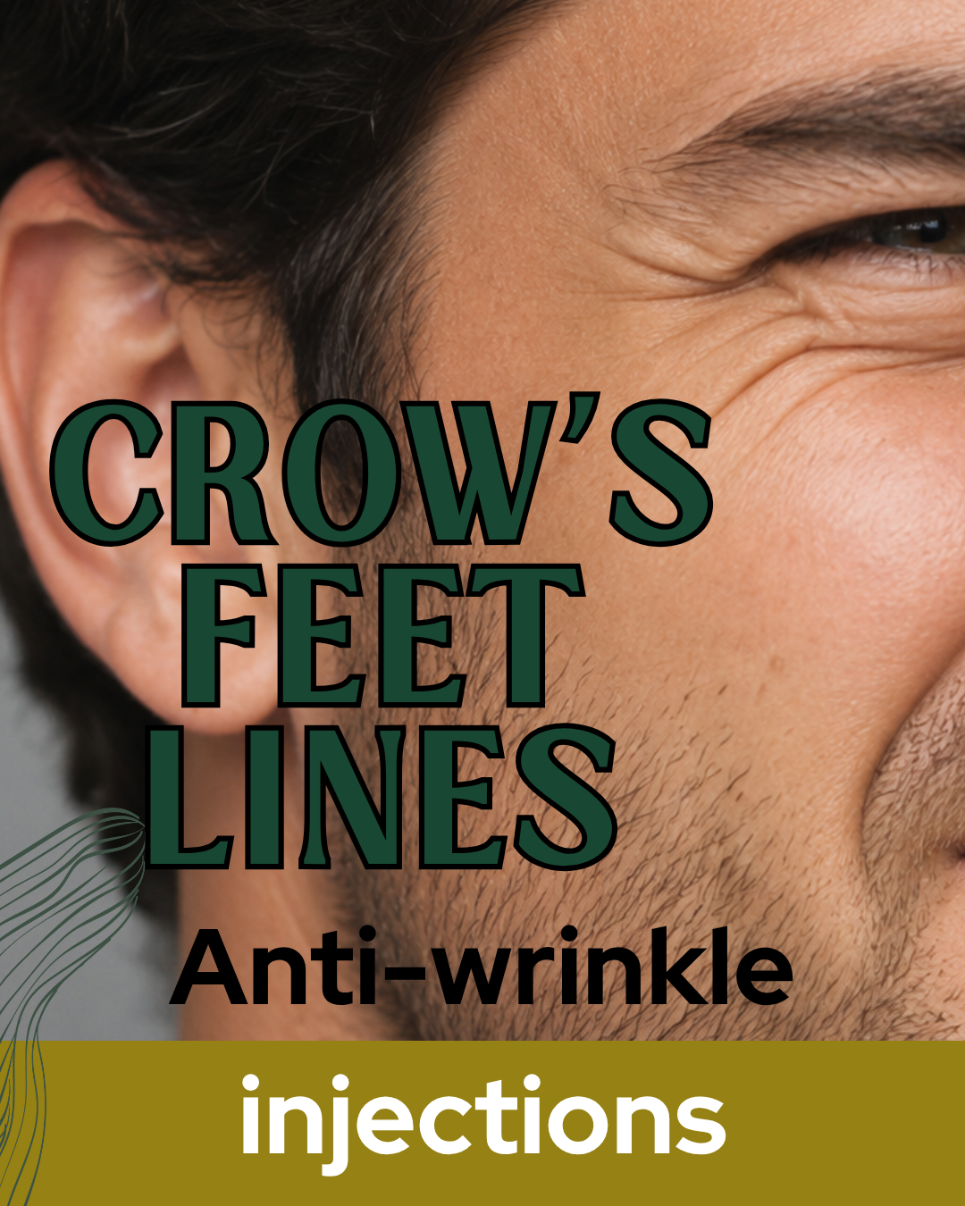Crow's Feet Wrinkles