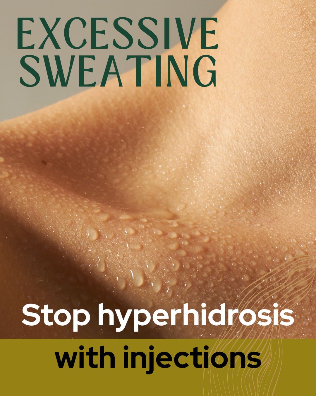 Stop Excessive Sweating With Botox Injections