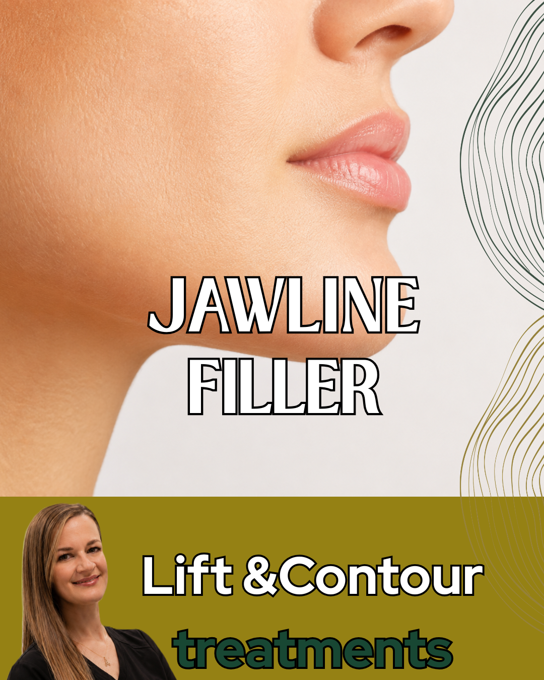 Jawline Filler 